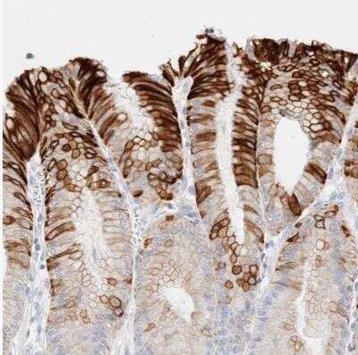 Immunohistochemistry-Paraffin: Cytokeratin 20 Antibody [NBP1-85599]
