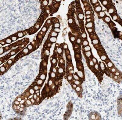 Immunohistochemistry-Paraffin: Cytokeratin 20 Antibody [NBP1-85599]