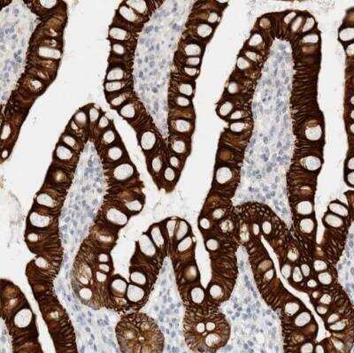 Immunohistochemistry-Paraffin: Cytokeratin 20 Antibody [NBP1-85599]