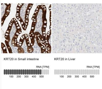 Immunohistochemistry-Paraffin: Cytokeratin 20 Antibody [NBP1-85599]