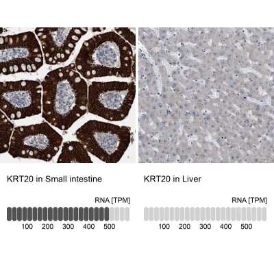Immunohistochemistry-Paraffin: Cytokeratin 20 Antibody [NBP1-85600]