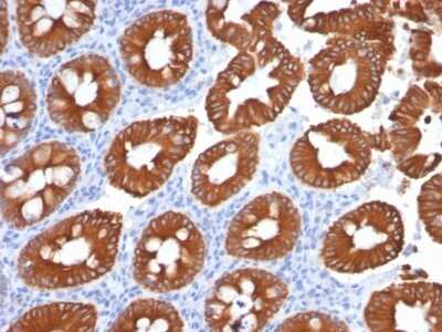 Immunohistochemistry-Paraffin: Cytokeratin 20 Antibody (KRT20/1991) - Azide and BSA Free [NBP3-08406]