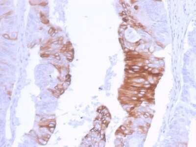 Immunohistochemistry-Paraffin: Cytokeratin 20 Antibody (KRT20/3129R) - Azide and BSA Free [NBP3-08636]