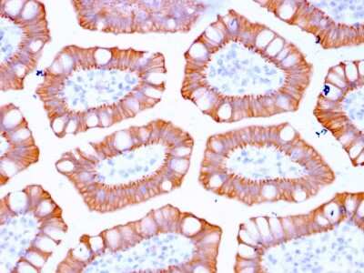 Immunohistochemistry-Paraffin: Cytokeratin 20 Antibody (KRT20/3129R) [NBP3-07634]