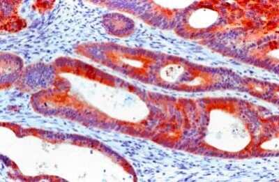 Immunohistochemistry-Paraffin: Cytokeratin 20 Antibody (Ks20.8) [NB120-854]