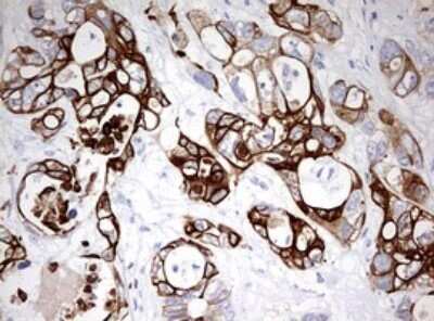 Immunohistochemistry: Cytokeratin 20 Antibody (OTI3G1) - Azide and BSA Free [NBP2-71962]