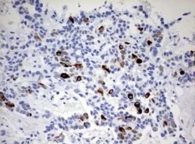 Immunohistochemistry: Cytokeratin 20 Antibody (OTI3G1) - Azide and BSA Free [NBP2-71962]
