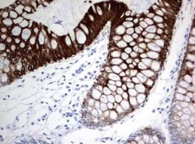 Immunohistochemistry: Cytokeratin 20 Antibody (OTI3G1) - Azide and BSA Free [NBP2-71962]