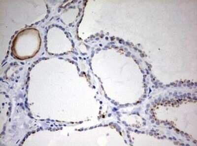 Immunohistochemistry: Cytokeratin 20 Antibody (OTI3G1) - Azide and BSA Free [NBP2-71962]