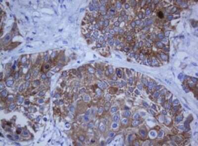 Immunohistochemistry: Cytokeratin 20 Antibody (OTI4A2) - Azide and BSA Free [NBP2-71961]