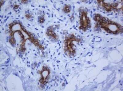 Immunohistochemistry: Cytokeratin 20 Antibody (OTI4A2) - Azide and BSA Free [NBP2-71961]