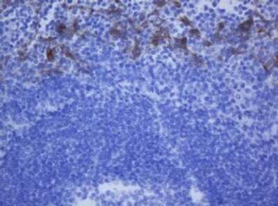 Immunohistochemistry: Cytokeratin 20 Antibody (OTI4A2) - Azide and BSA Free [NBP2-71961]
