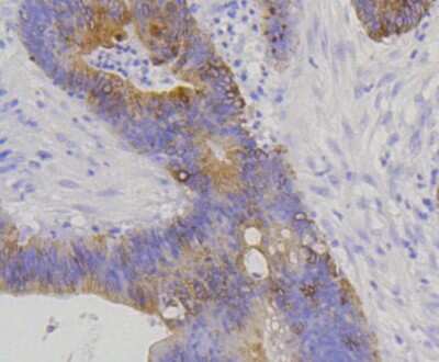 Immunohistochemistry-Paraffin: Cytokeratin 20 Antibody (SA35-03) [NBP2-67309]