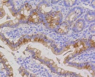 Immunohistochemistry-Paraffin: Cytokeratin 20 Antibody (SA35-03) [NBP2-67309]