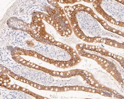 Immunohistochemistry-Paraffin: Cytokeratin 20 Antibody (SA35-03) [NBP2-67309]