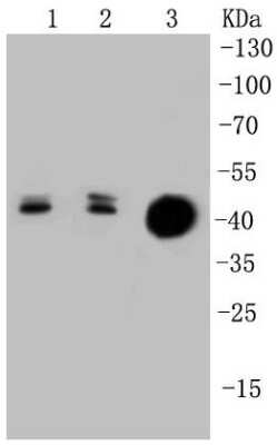 Western Blot: Cytokeratin 20 Antibody (SA35-03) [NBP2-67309]