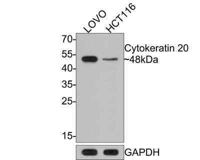 Western Blot: Cytokeratin 20 Antibody (SA35-03) [NBP2-67309]