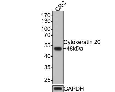 Western Blot: Cytokeratin 20 Antibody (SA35-03) [NBP2-67309]