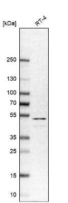 Western Blot: Cytokeratin 20 Antibody [NBP1-85598]