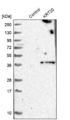 Western Blot: Cytokeratin 20 Antibody [NBP1-85600]