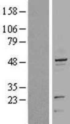 Western Blot: Cytokeratin 20 Overexpression Lysate [NBL1-12388]