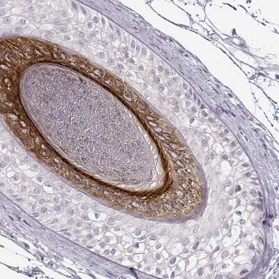 Immunohistochemistry-Paraffin: Cytokeratin 26 Antibody [NBP2-55508]