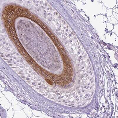 Immunohistochemistry-Paraffin: Cytokeratin 27 Antibody [NBP2-55440]