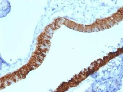Immunohistochemistry-Paraffin: Cytokeratin 3 Antibody (KRT3/2130) - Azide and BSA Free [NBP2-79852]