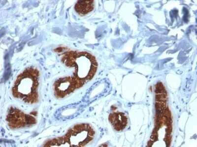 Immunohistochemistry-Paraffin: Cytokeratin 3 Antibody (KRT3/2130) - Azide and BSA Free [NBP2-79852]