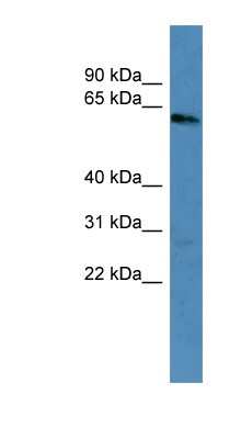 Western Blot: Cytokeratin 3 Antibody [NBP1-69045]