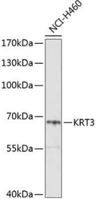 Western Blot: Cytokeratin 3 AntibodyBSA Free [NBP2-91997]