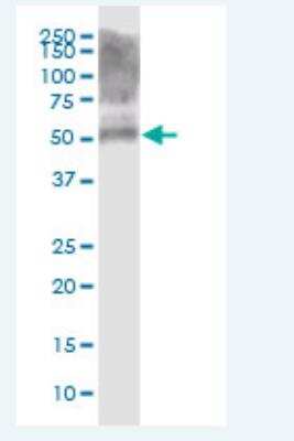 Western Blot: Cytokeratin 39 Antibody [H00390792-B01P-50ug]