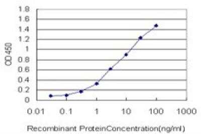 ELISA: Cytokeratin 4 Antibody (5H5) [H00003851-M01]