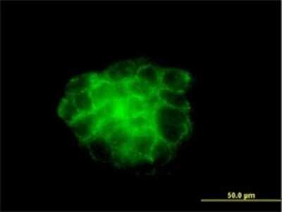 Immunocytochemistry/ Immunofluorescence: Cytokeratin 4 Antibody (5H5) [H00003851-M01]