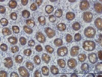 Immunohistochemistry-Paraffin: Cytokeratin 4 Antibody (5H5) [H00003851-M01]