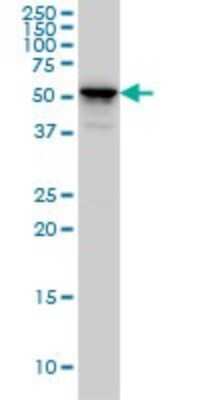 Western Blot: Cytokeratin 4 Antibody (5H5) [H00003851-M01]