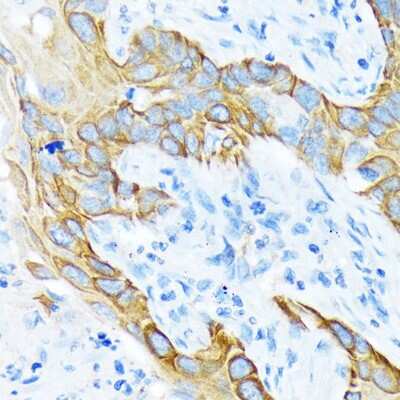 Immunohistochemistry-Paraffin: Cytokeratin 4 Antibody (6H9R6) [NBP3-15243]