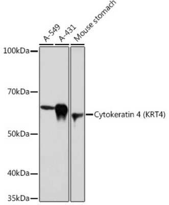 Western Blot: Cytokeratin 4 Antibody (6H9R6) [NBP3-15243]