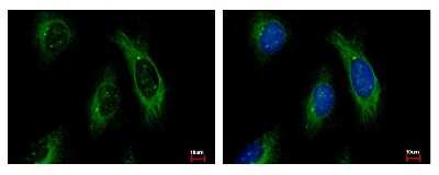 Immunocytochemistry/ Immunofluorescence: Cytokeratin 4 Antibody [NBP1-33412]