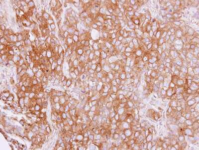 Immunohistochemistry-Paraffin: Cytokeratin 4 Antibody [NBP1-33412]
