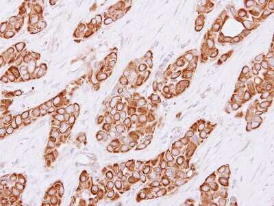 Immunohistochemistry-Paraffin: Cytokeratin 4 Antibody [NBP1-33592]