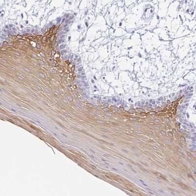 Immunohistochemistry-Paraffin: Cytokeratin 4 Antibody [NBP2-33984]
