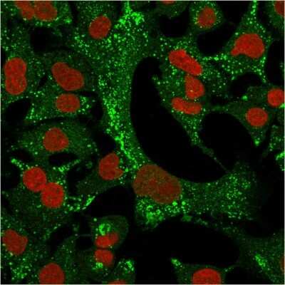 Immunocytochemistry/ Immunofluorescence: Cytokeratin 4 Antibody (KRT4/2804) [NBP3-07797]