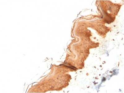 Immunohistochemistry-Paraffin: Cytokeratin 4 Antibody (KRT4/2804) - Azide and BSA Free [NBP3-08583]