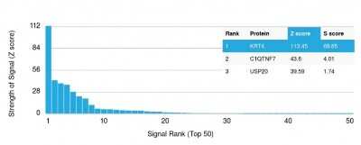 Protein Array: Cytokeratin 4 Antibody (KRT4/2804) [NBP3-07797]