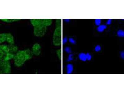 Immunocytochemistry/ Immunofluorescence: Cytokeratin 4 Antibody (SN74-03) [NBP2-67706]