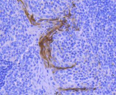 Immunohistochemistry-Paraffin: Cytokeratin 4 Antibody (SN74-03) [NBP2-67706]