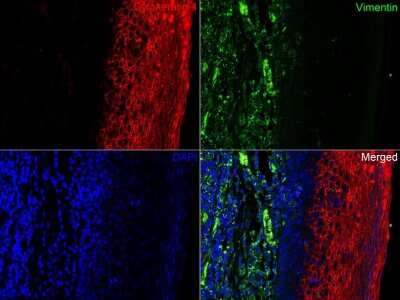Immunohistochemistry-Paraffin: Cytokeratin 4 Antibody (SN74-03) [NBP2-67706]