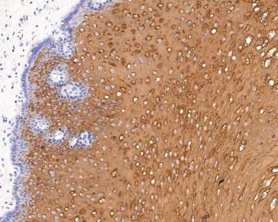 Immunohistochemistry-Paraffin: Cytokeratin 4 Antibody (SN74-03) [NBP2-67706]