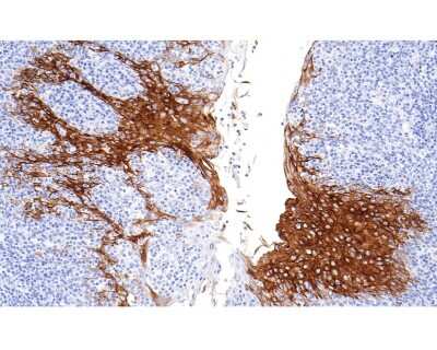 Immunohistochemistry-Paraffin: Cytokeratin 4 Antibody (SN74-03) [NBP2-67706]